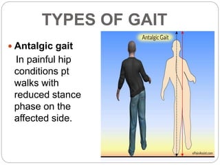 Assessment and special tests of Hip joint | PPTX
