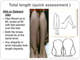 Allis Sign Leg