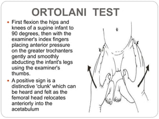 Scouring Test Hip Scour Test