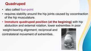 Methods of assessment in paediatrics rehabilitation | PDF