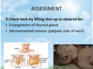 ASSESSMENT
9.Check neck-by lifting chin up to observe for:
• Enlargement of thyroid gland
• Sternomastoid tumour (palpate side of neck)
 