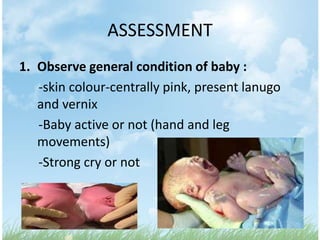 ASSESSMENT
1. Observe general condition of baby :
   -skin colour-centrally pink, present lanugo
   and vernix
   -Baby active or not (hand and leg
   movements)
   -Strong cry or not
 
