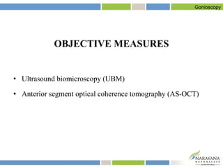 OBJECTIVE MEASURES
• Ultrasound biomicroscopy (UBM)
• Anterior segment optical coherence tomography (AS-OCT)
Gonioscopy
 