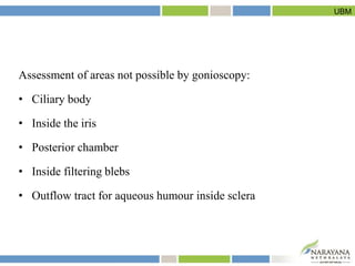 Assessment of areas not possible by gonioscopy:
• Ciliary body
• Inside the iris
• Posterior chamber
• Inside filtering bl...