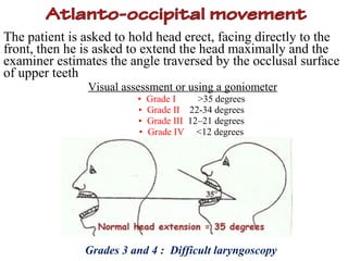 Delikan Test Assessment of airway | PPT