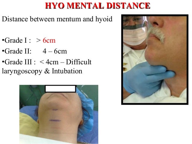 Assessment of airway