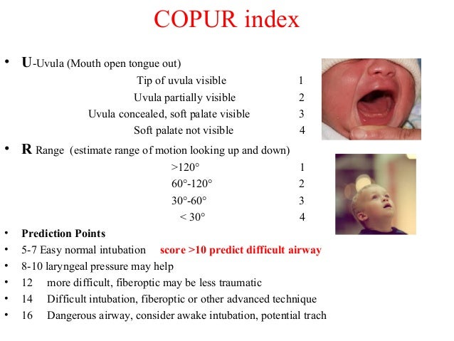 Assessment of airway