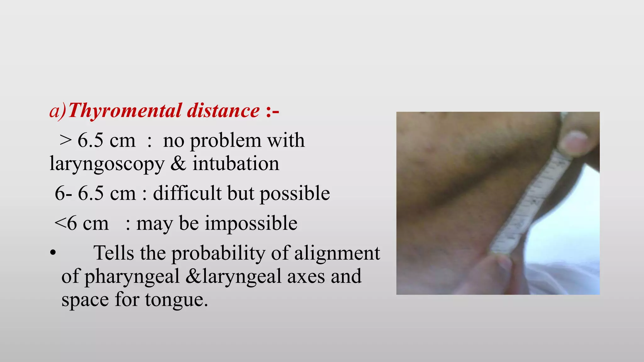 Assessment of airway | PPTX
