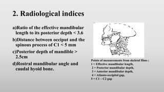 Assessment of airway | PPTX