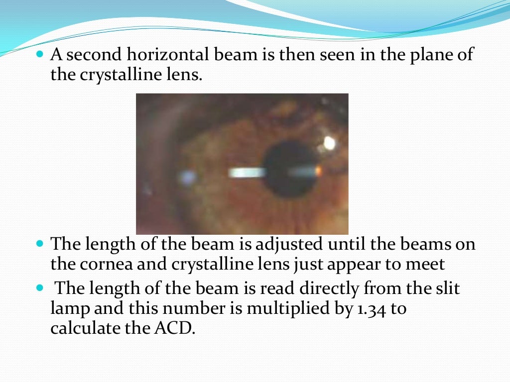 Assessment of anterior chamber