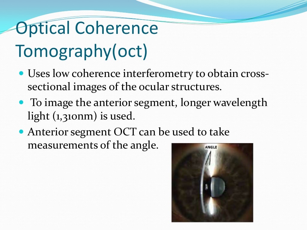 Assessment of anterior chamber