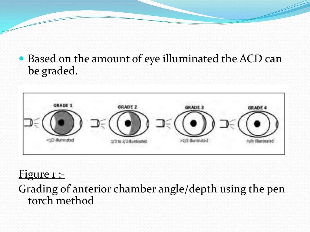Assessment of anterior chamber