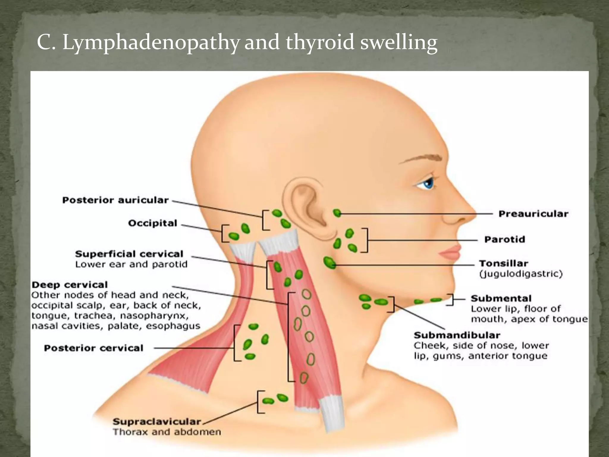 C. Lymphadenopathy and thyroid swelling
 