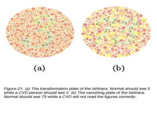 Assessment of color vision | PPT