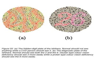 Assessment of color vision | PPT