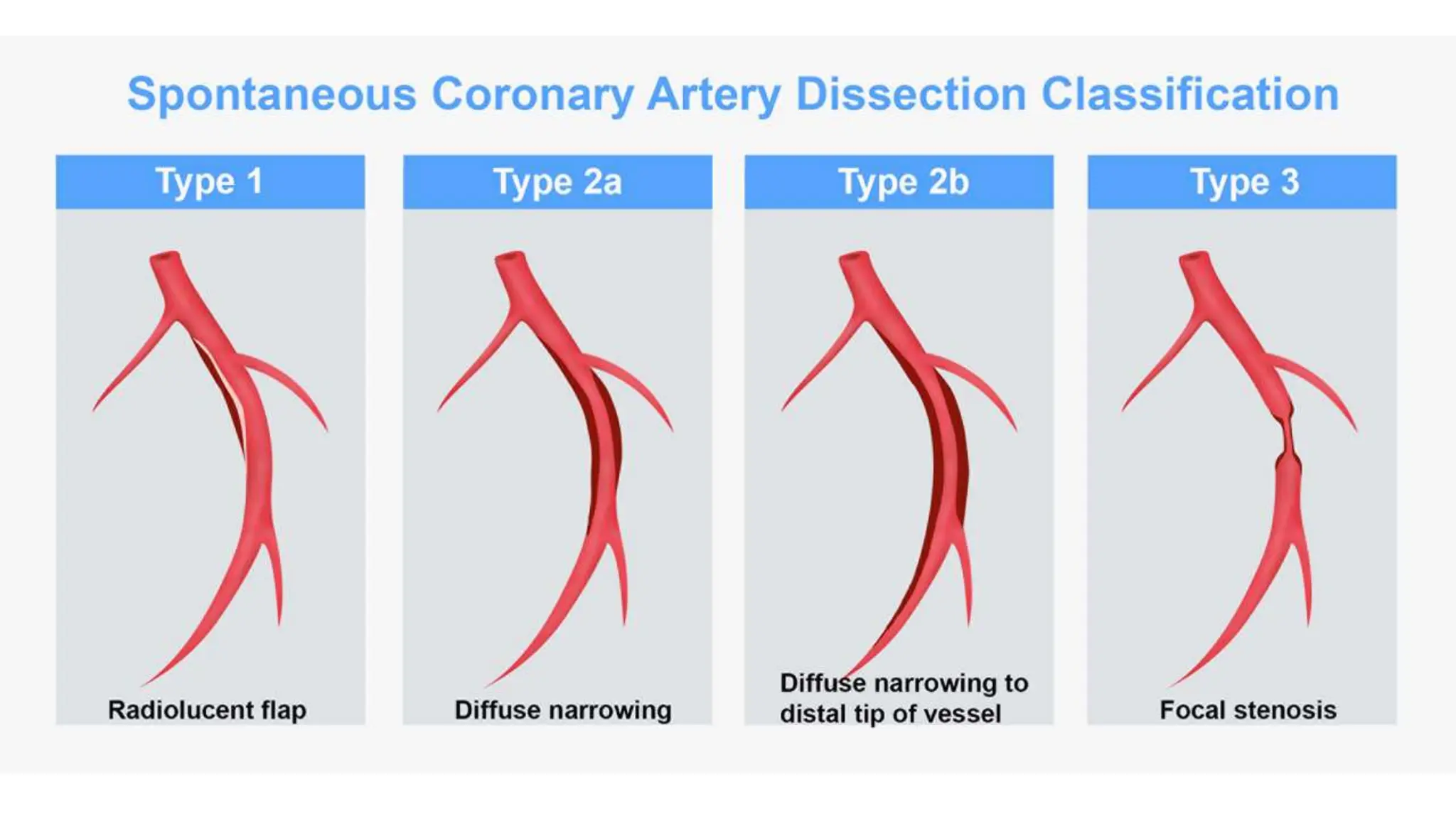 Assessment of Coronary Artery Disease.pptx | Heart and Cardiovascular ...