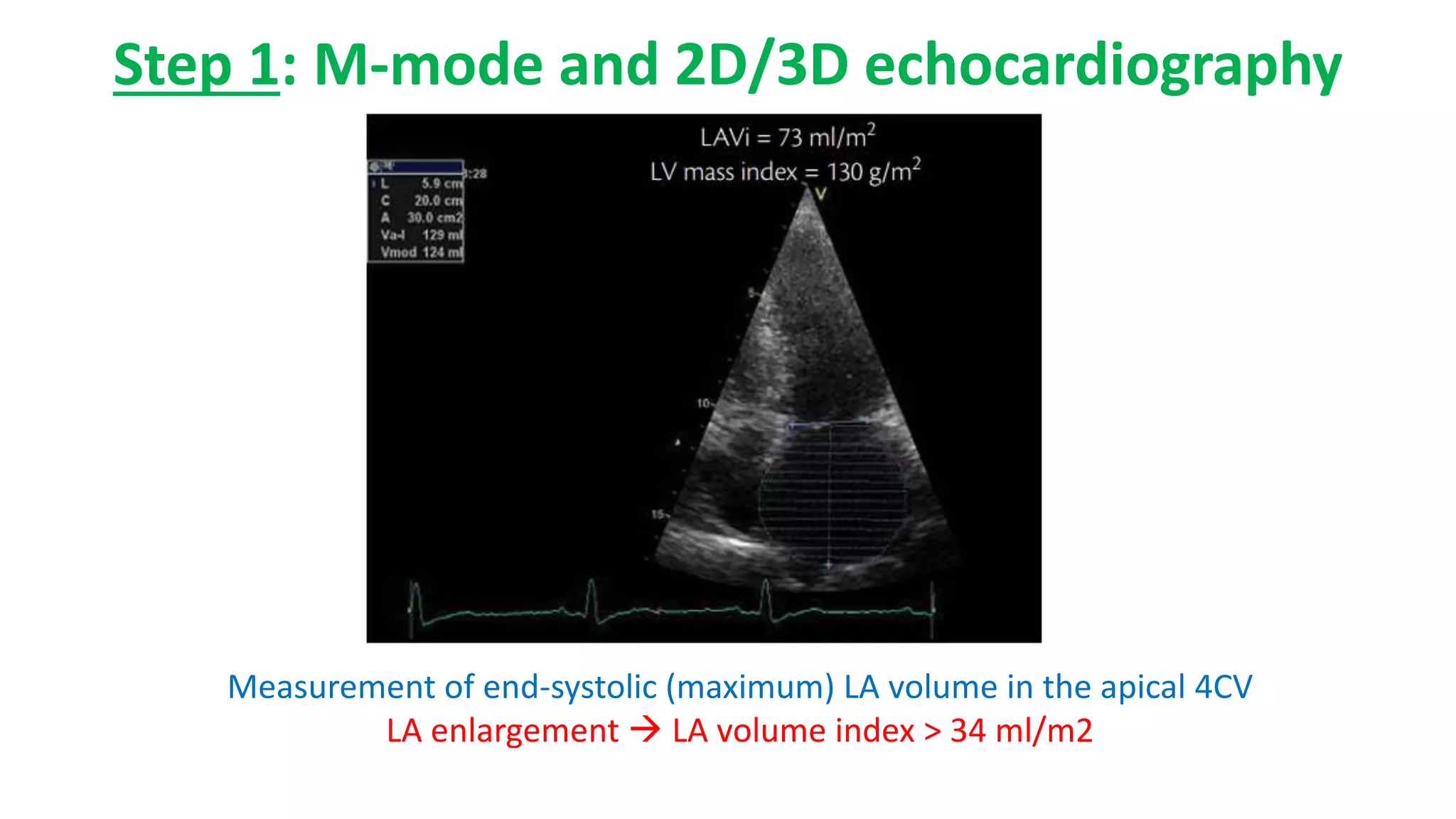 Step 1: M-mode and 2D/3D echocardiography
Measurement of end-systolic (maximum) LA volume in the apical 4CV
LA enlargement  LA volume index > 34 ml/m2
 