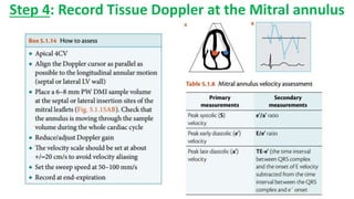 Step 4: Record Tissue Doppler at the Mitral annulus
 