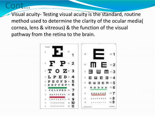 Assessment of eye.pptx