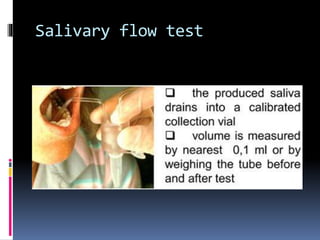 Salivary flow test
 