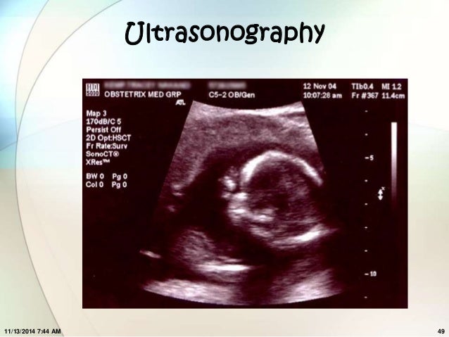 Assessment Of Fetal Wellbeing