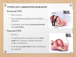 Assessment_of_Fetal_Well_Being. bsc nursing vi sem pptx | PPTX