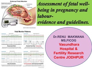 Dr.RENU MAKWANA
MS,FICOG
Vasundhara
Hospital &
Fertility Research
Centre JODHPUR
 