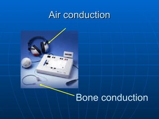 Air conduction Bone conduction 