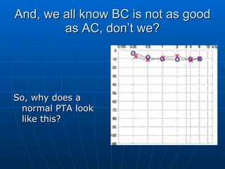 And, we all know BC is not as good as AC, don’t we? So, why does a normal PTA look like this? 