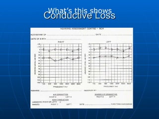 Conductive Loss What’s this shows 