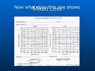 Mixed Loss Now what does this one shows 