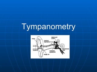 Tympanometry 