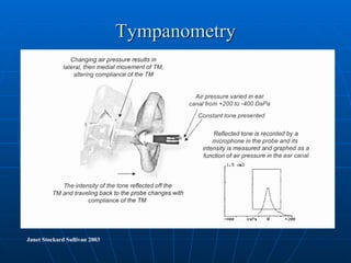 Tympanometry Janet Stockard Sullivan 2003 