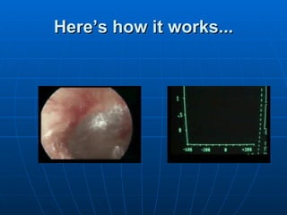 Here’s how it works... 