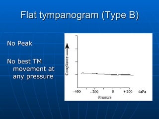 Flat tympanogram (Type B) No Peak No best TM movement at any pressure 