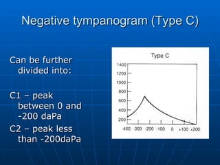 Negative tympanogram (Type C) Can be further divided into: C1 – peak between 0 and -200 daPa C2 – peak less than -200daPa 