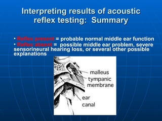 Interpreting results of acoustic reflex testing:  Summary Reflex   present  = probable normal middle ear function Reflex   absent  =  possible middle ear problem, severe sensorineural hearing loss, or several other possible explanations 