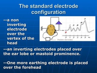 The standard electrode configuration --a non inverting electrode over the vertex of the head --an inverting electrodes placed over the ear lobe or mastoid prominence.  --One more earthing electrode is placed over the forehead 
