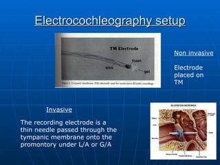 Electrocochleography setup The recording electrode is a thin needle passed through the tympanic membrane onto the promontory under L/A or G/A Non invasive Electrode placed on TM Invasive 