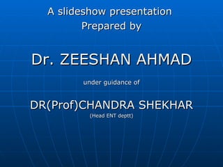 A slideshow presentation  Prepared by Dr. ZEESHAN AHMAD under guidance of DR(Prof)CHANDRA SHEKHAR (Head ENT deptt) THANK YOU 