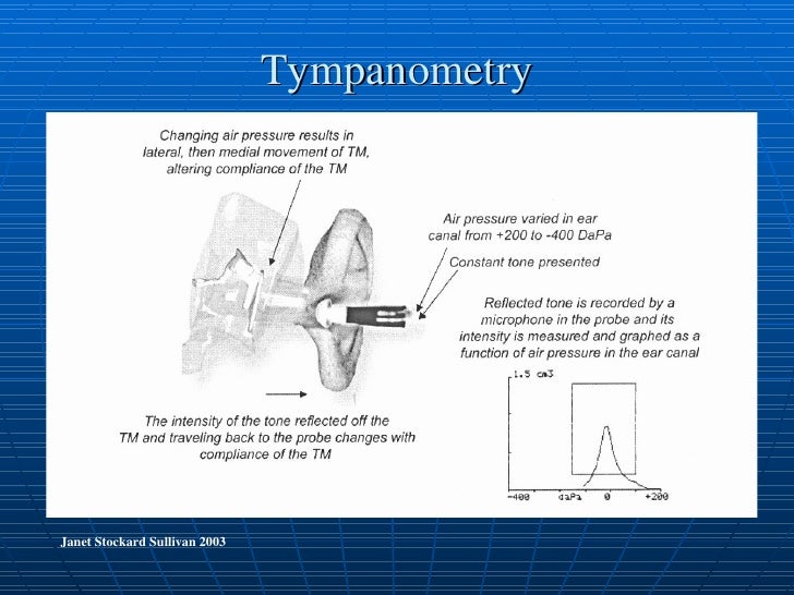 Assessment of hearing