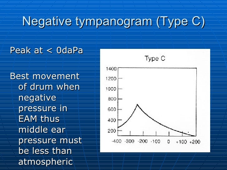 Assessment of hearing