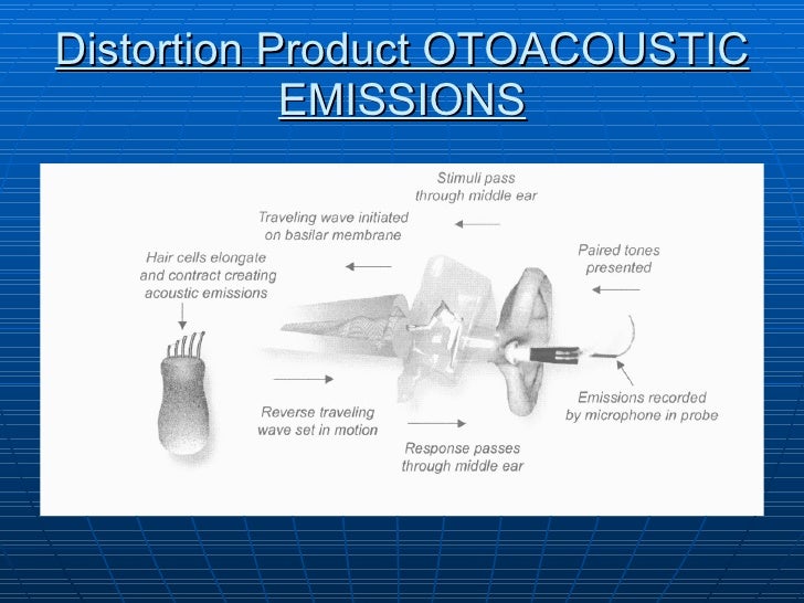 Assessment of hearing