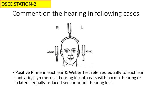 Assessment Of Hearing With Self Assessment Questions