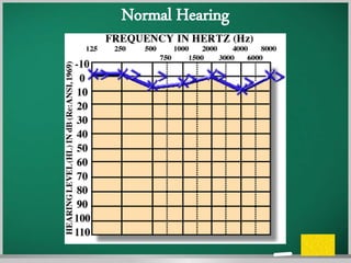 Assessment of hearing | PPTX