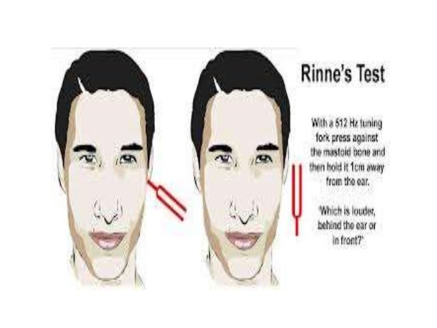 tuning fork test tuning fork test