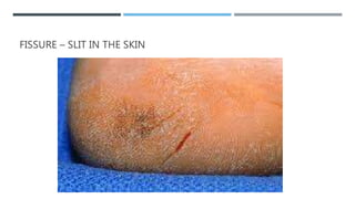 Slit Def Clinical Assessment of integumentary system | PPTX
