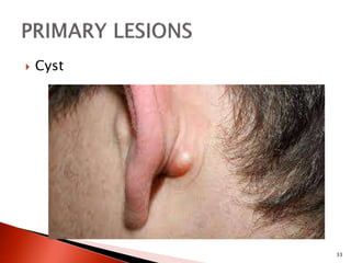 Assessment of integumentry system | PPTX