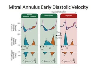 ASSESSMENT OF LEFT VENTRICULAR DIASTOLIC FUNCTION seminar 2.pptx