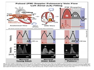 ASSESSMENT OF LEFT VENTRICULAR DIASTOLIC FUNCTION seminar 2.pptx